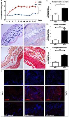 B Cell Homeostasis and Functional Properties Are Altered in an Hypochlorous Acid-Induced Murine Model of Systemic Sclerosis